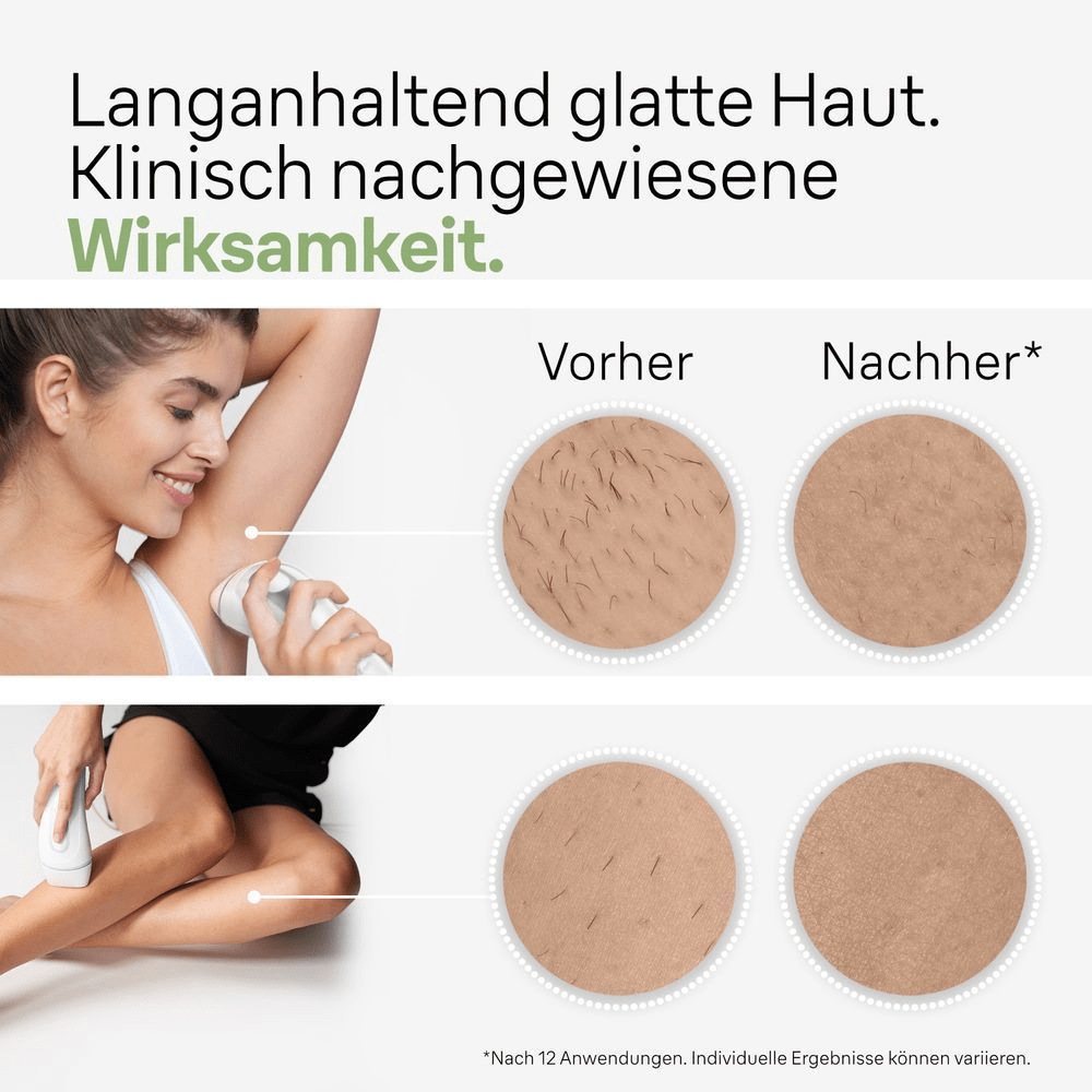 Bild: Braun IPL Silk·expert Pro 3 PL3122