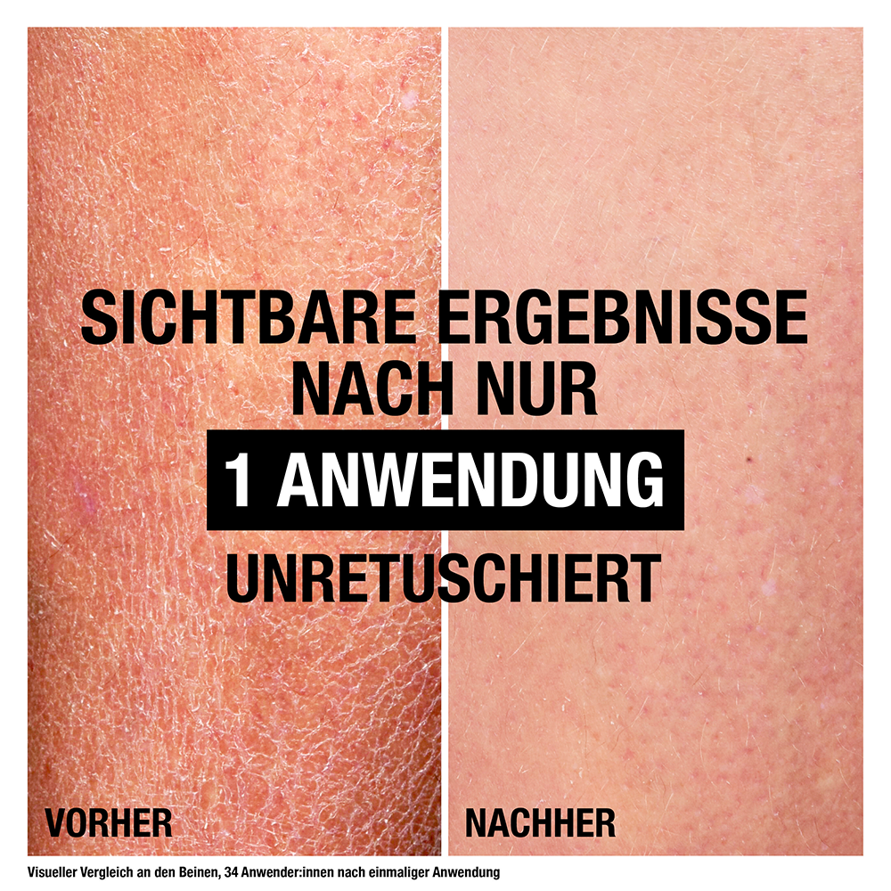 Bild: Neutrogena Deep Moisture Bodylotion Sofort Einziehend Reisegröße