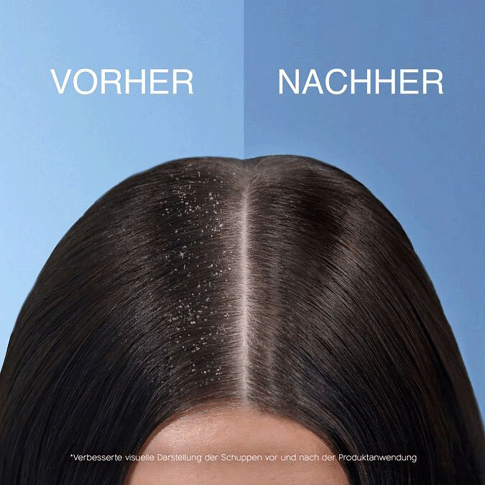 Bild: head & shoulders Juckende Kopfhaut Shampoo