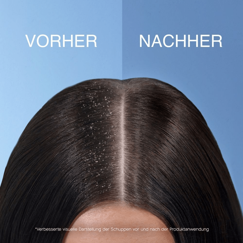 Bild: head & shoulders Juckende Kopfhaut Shampoo