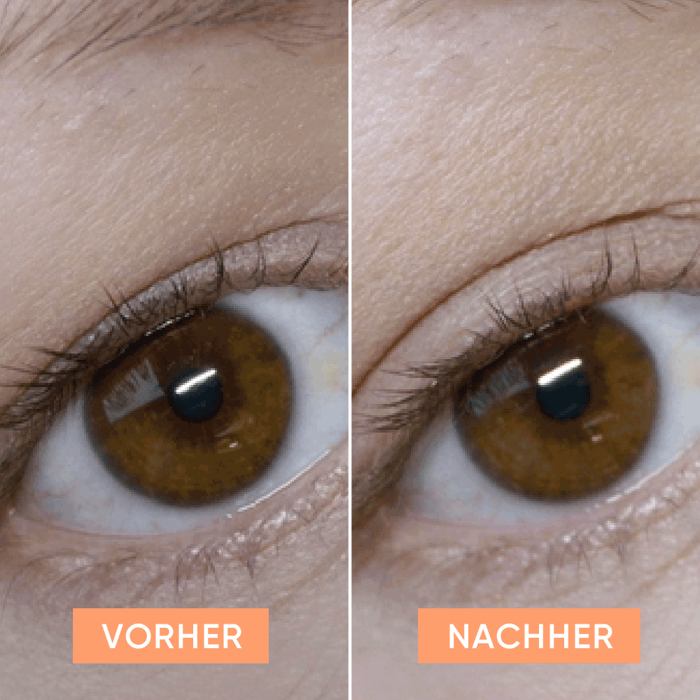 Bild: APRICOT Beauty Augenlid Tapes Bye sleepy eye 