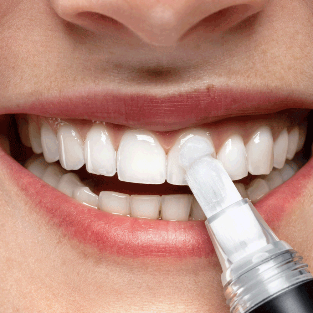 Bild: Smilepen Power Whitening Kit