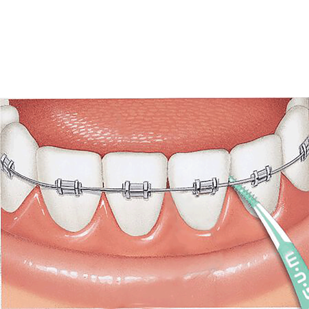 Bild: GUM Soft Picks Advanced Medium 
