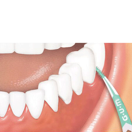 Bild: GUM Soft Picks Advanced Medium 
