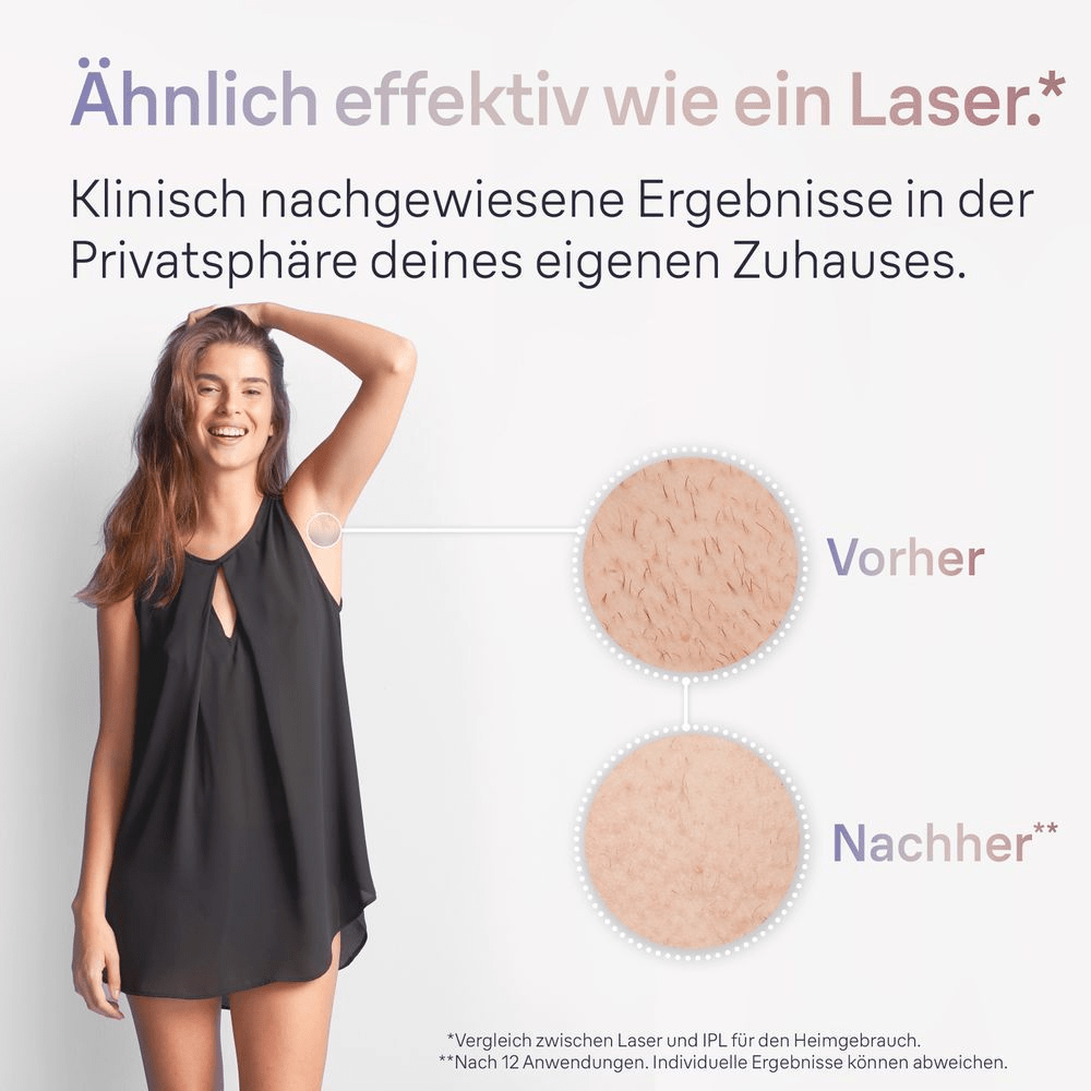 Bild: Braun IPL Skin i·expert PL7147