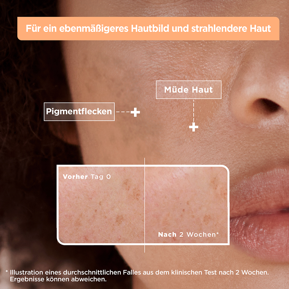 Bild: Mixa Anti-Pigmentflecken Serum