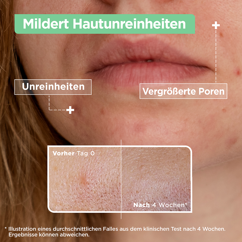 Bild: Mixa Anti-Unreinheiten Serum