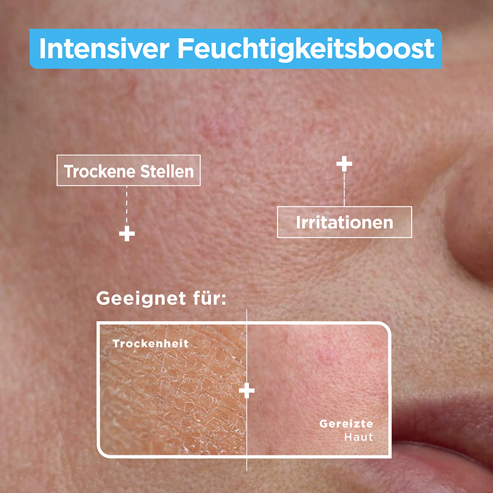 Bild: Mixa Anti-Trockenheit Serum