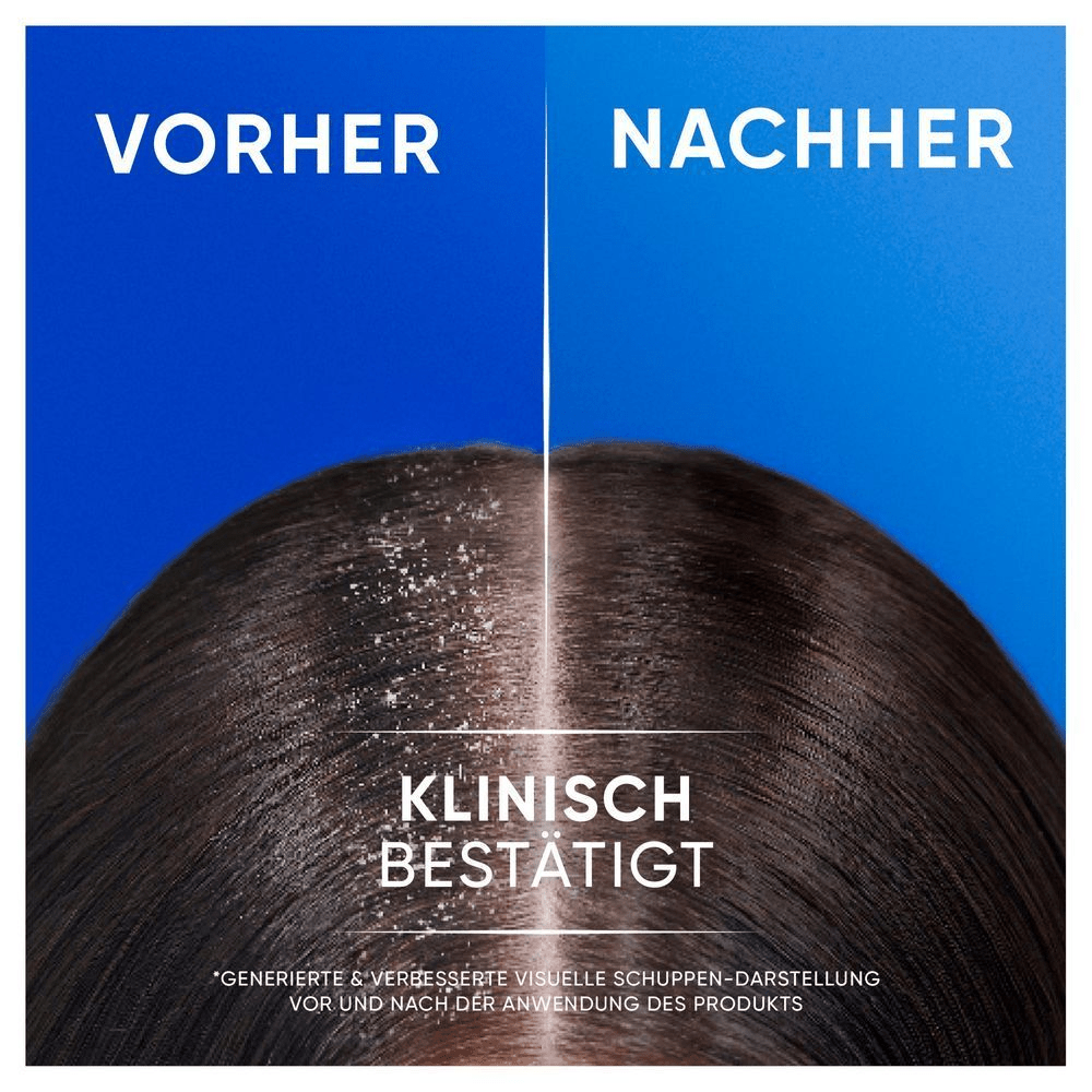 Bild: head & shoulders Apple Fresh 2-in-1 Anti-Schuppen Shampoo