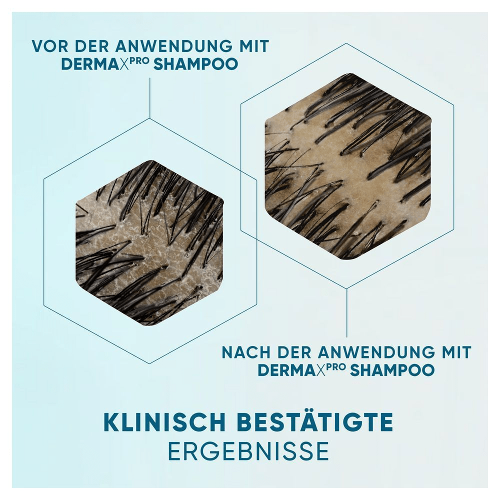 Bild: head & shoulders DERMAXPRO Beruhigend Anti-Schuppen Shampoo