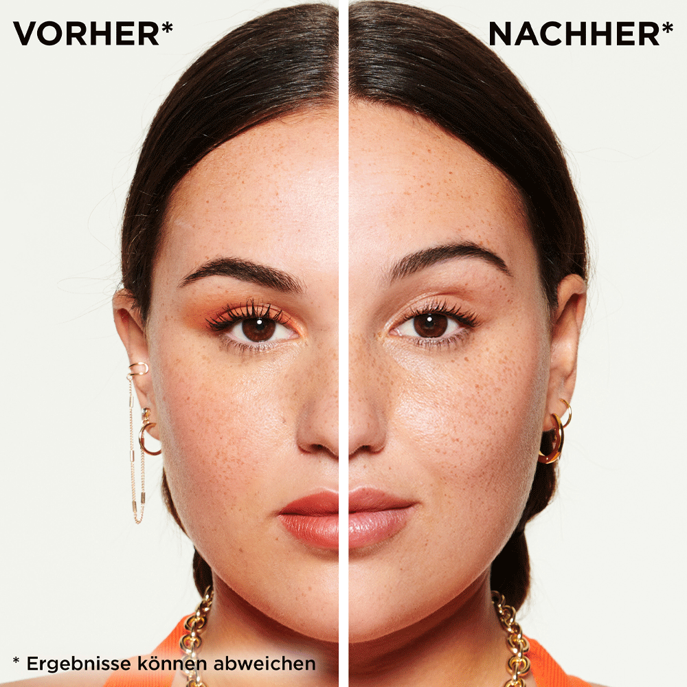 Bild: GARNIER SKIN ACTIVE Sanftes Mizellen Peelingwasser