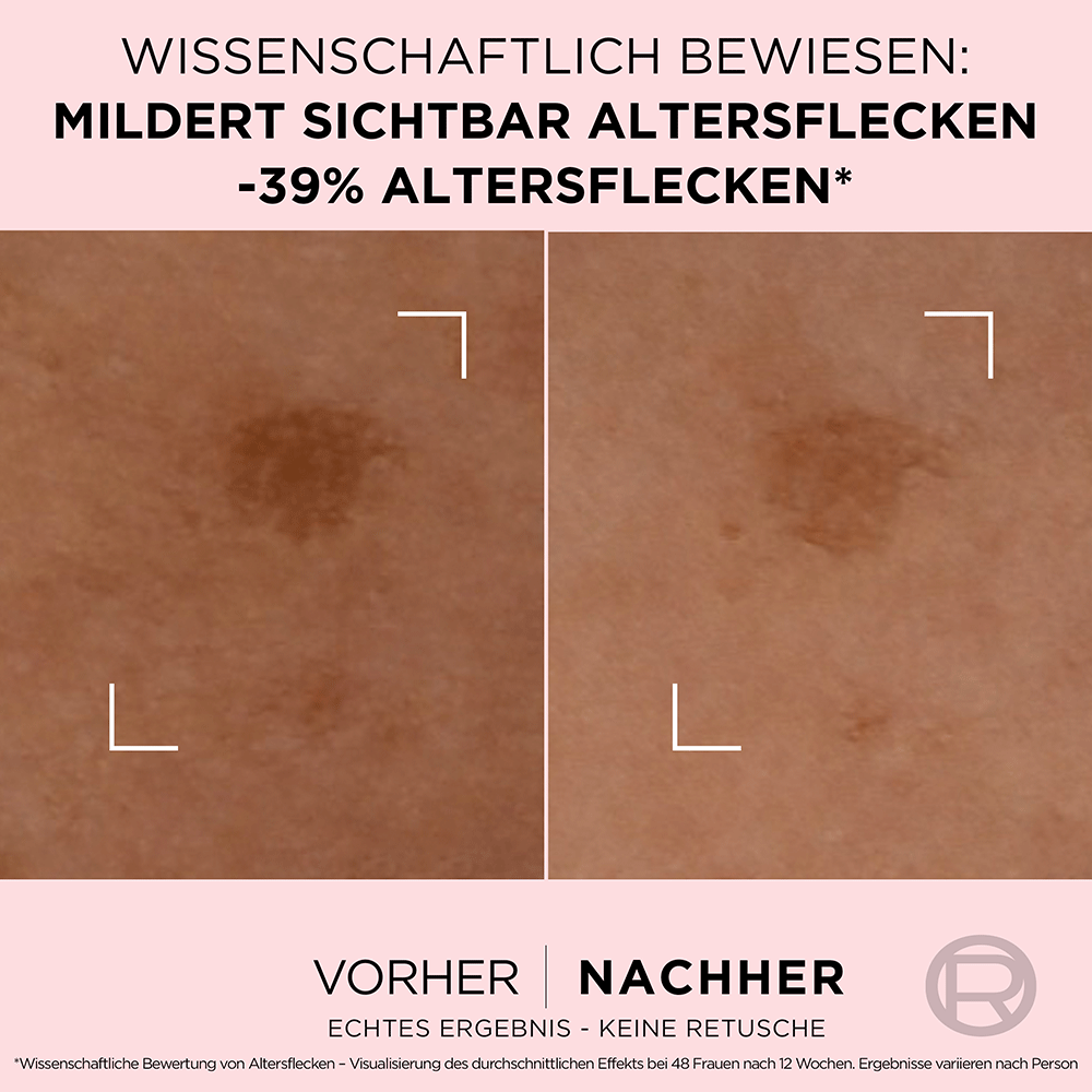 Bild: L'ORÉAL PARIS Age Perfect Anti-Altersflecken Fluid