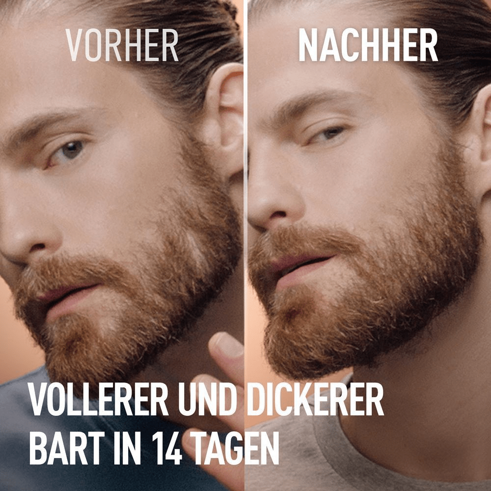 Bild: Gillette Bartvolumen-Serum für Männer