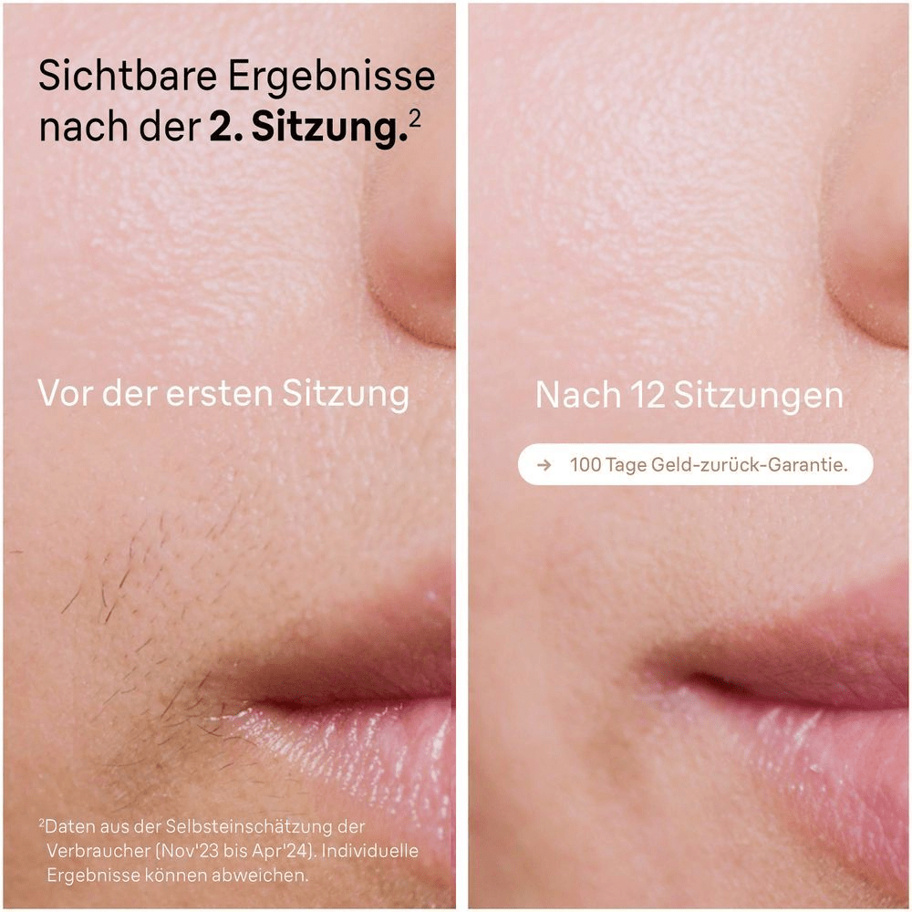 Bild: Braun IPL Silk·expert Pro 5, Haarentfernung für zuhause, PL5052 