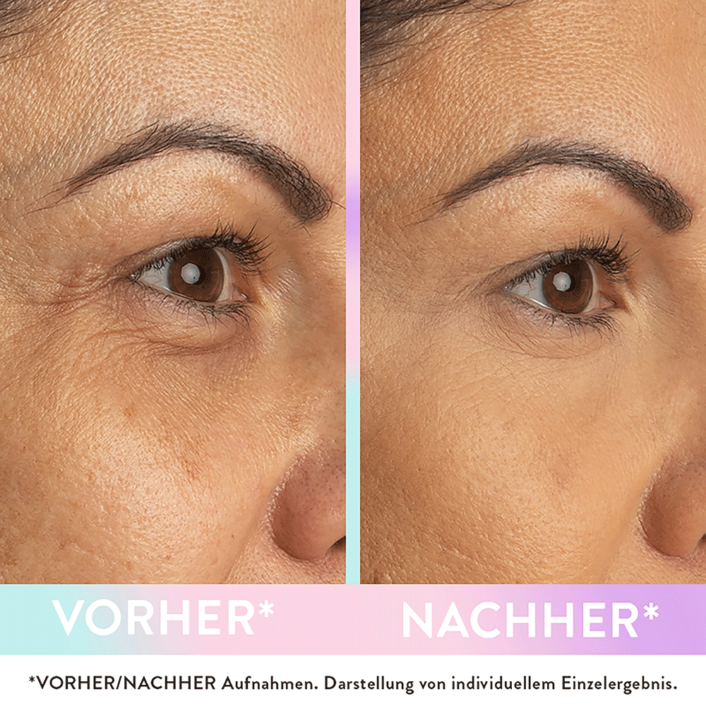 Bild: Judith Williams Magic Wonder Eye Balm Augenpflege Hauttonanpassend