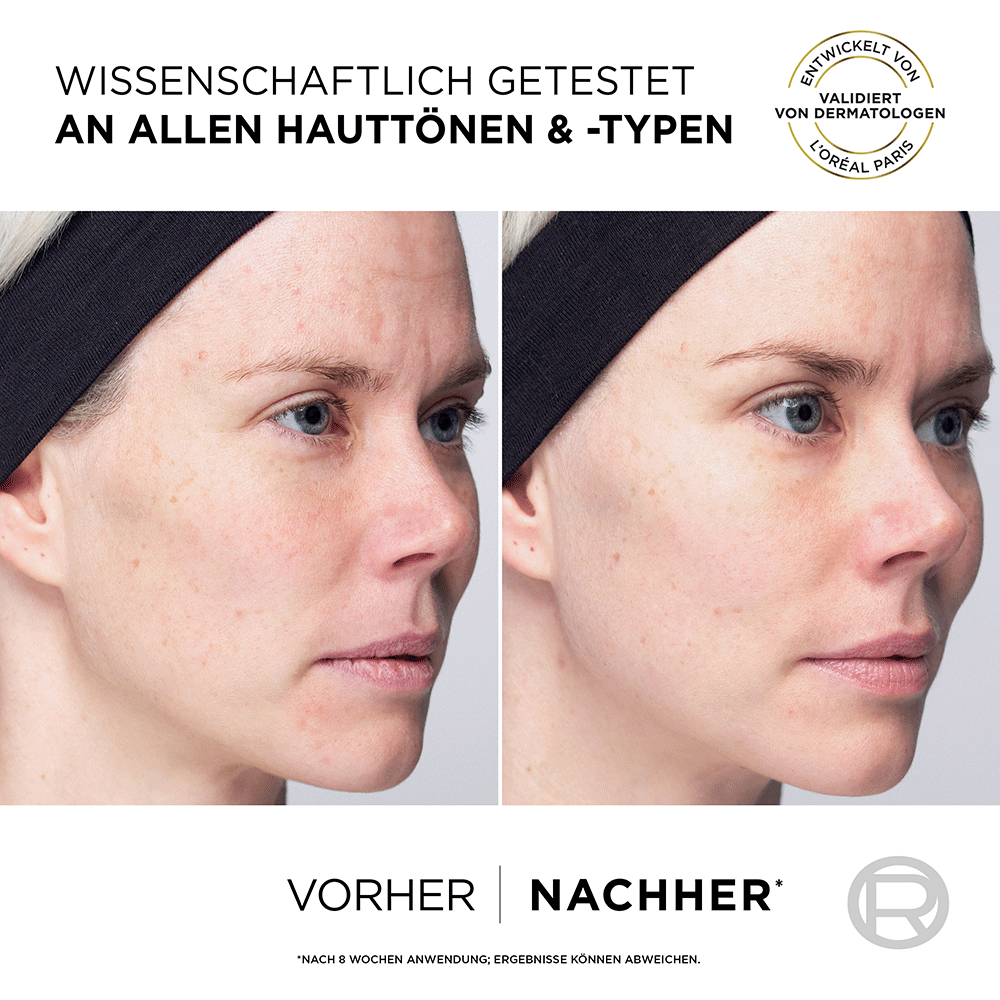 Bild: L'ORÉAL PARIS Revitalift Vitamin C Duo