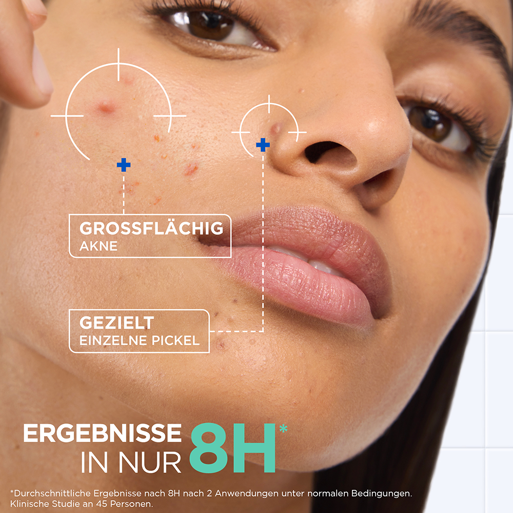 Bild: Mixa Konzentrierte Anti-Pickel-Paste