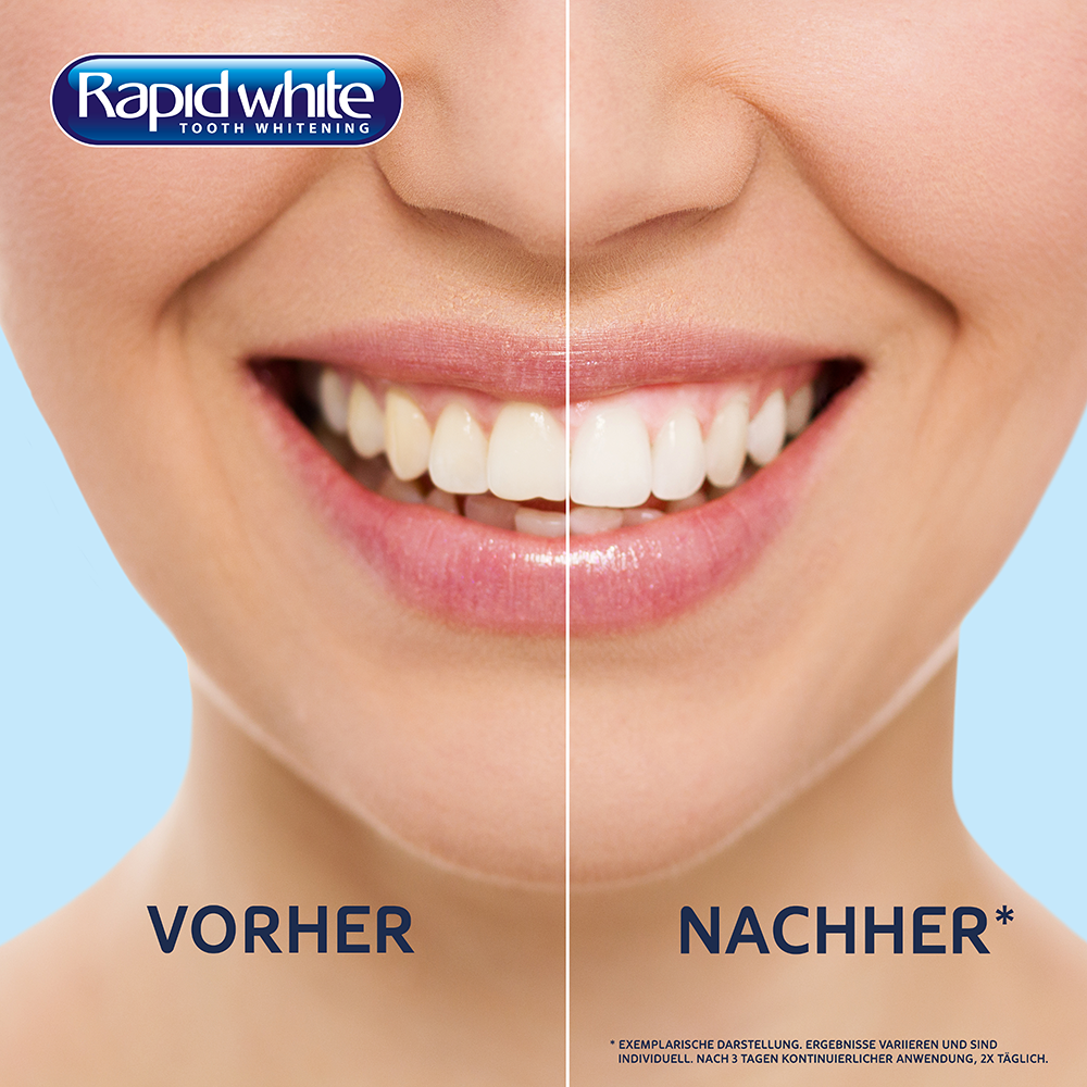 Bild: Rapid White Bleaching Strips