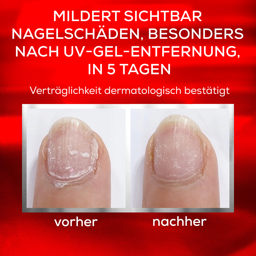 Bild: Essie To the rescue Nagelpflege