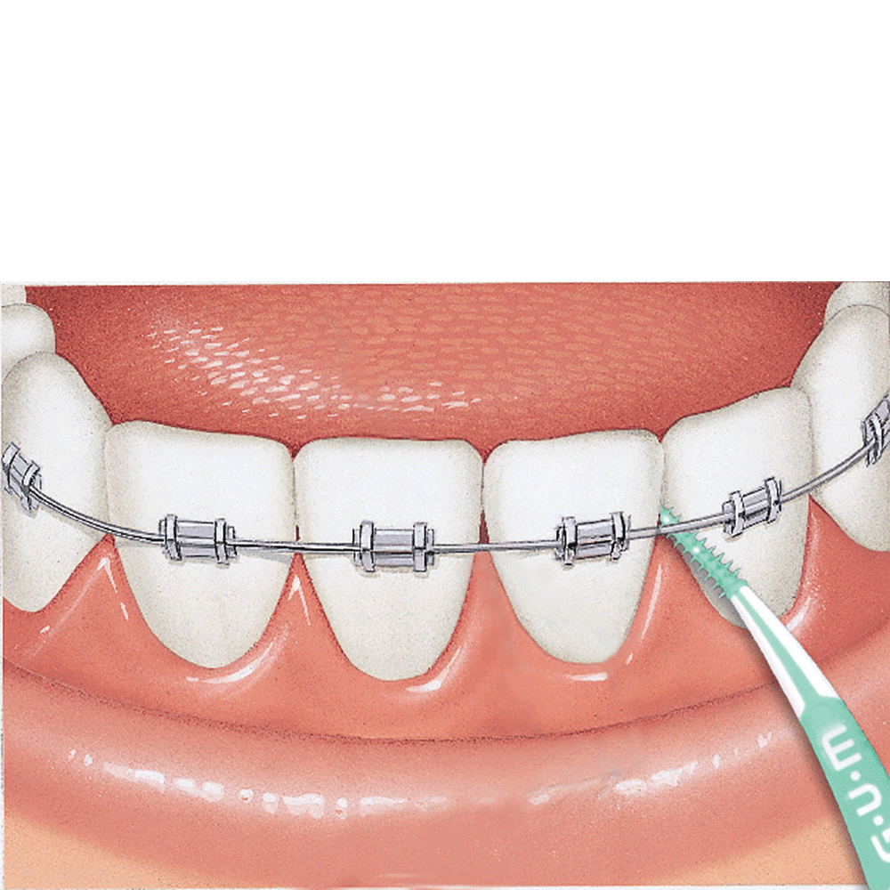 Bild: GUM SOFT-PICKS Advanced Small 