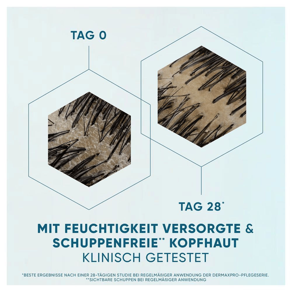 Vergleich einer Kopfhautbehandlung: Tag 0 und Tag 28 mit mikroskopischen Aufnahmen der Haarfollikel