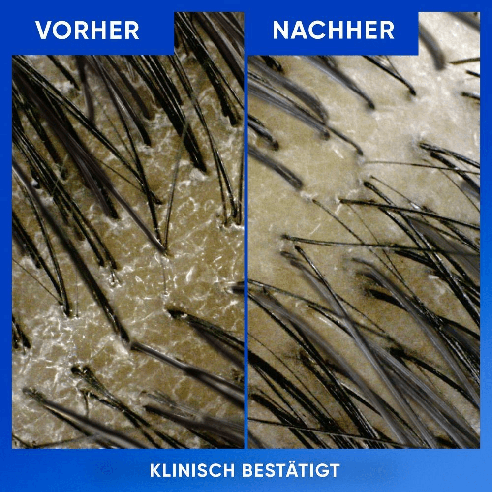 Bild: head & shoulders Clarify & Shine Anti-Schuppen-Shampoo 