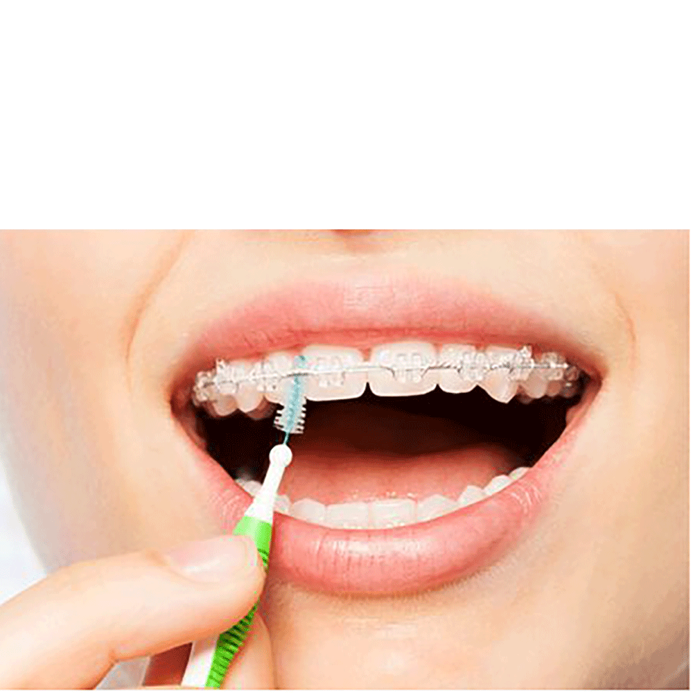 Bild: GUM TRAV-LER Interdentalbürste 0,8 mm