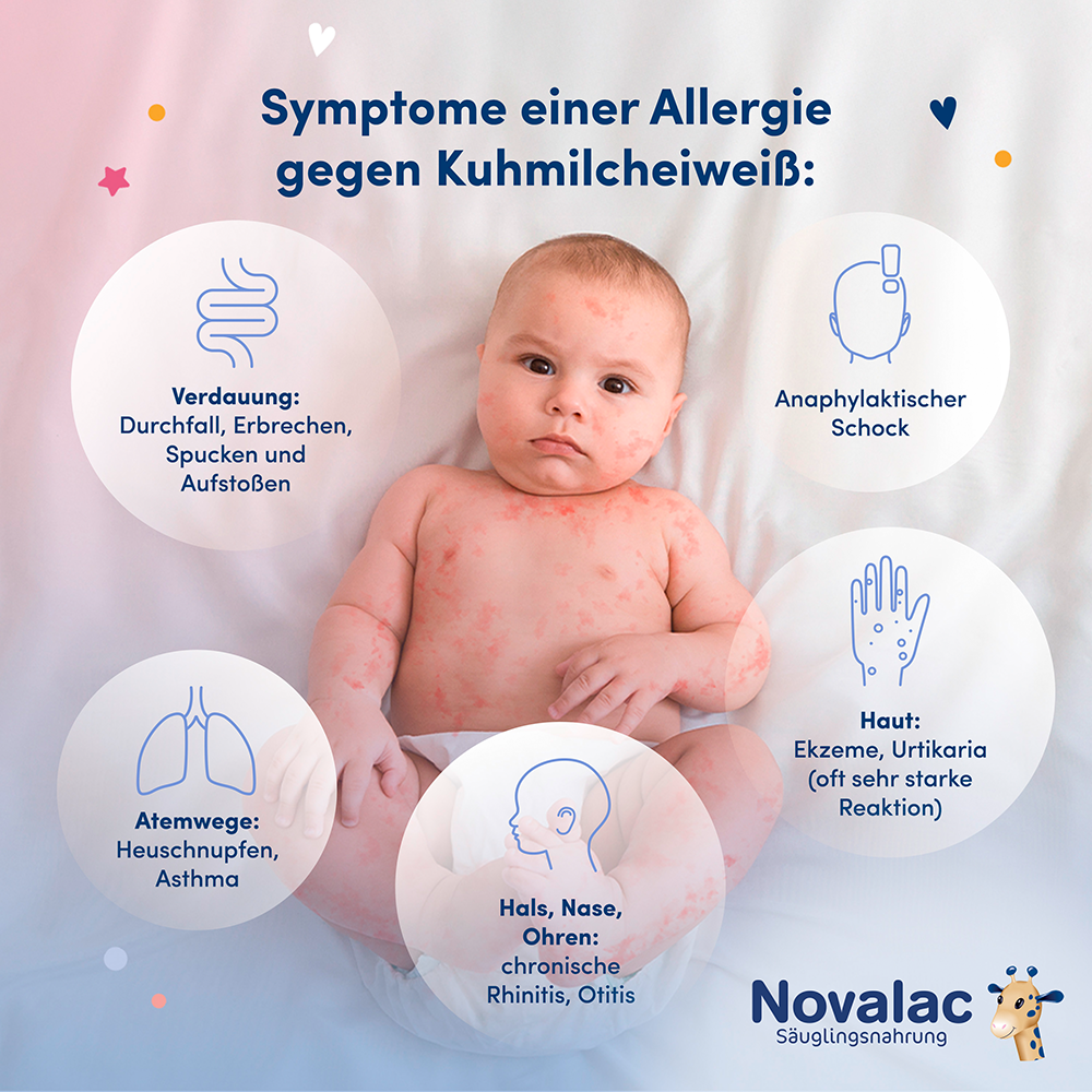 Bild: Novalac Rice AR Spezialnahrung bei Kuhmilchallergien 