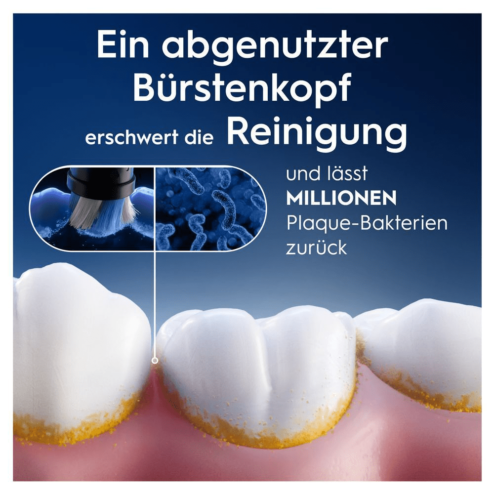Oral-B: Ein abgenutzter Bürstenkopf erschwert die Reinigung und lässt Millionen Plaque-Bakterien zurück, wie auf den Zähnen dargestellt.