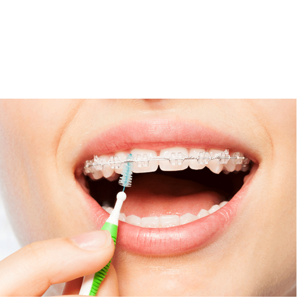 Bild: GUM TRAV-LER Interdentalbürste 0,6 mm 