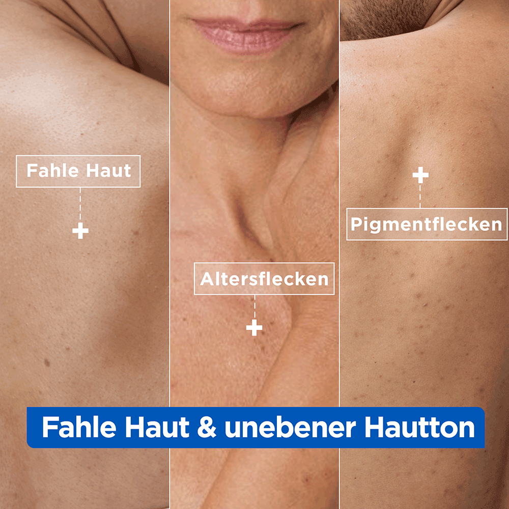 Bild: Mixa Niacinamide Bright Creme 