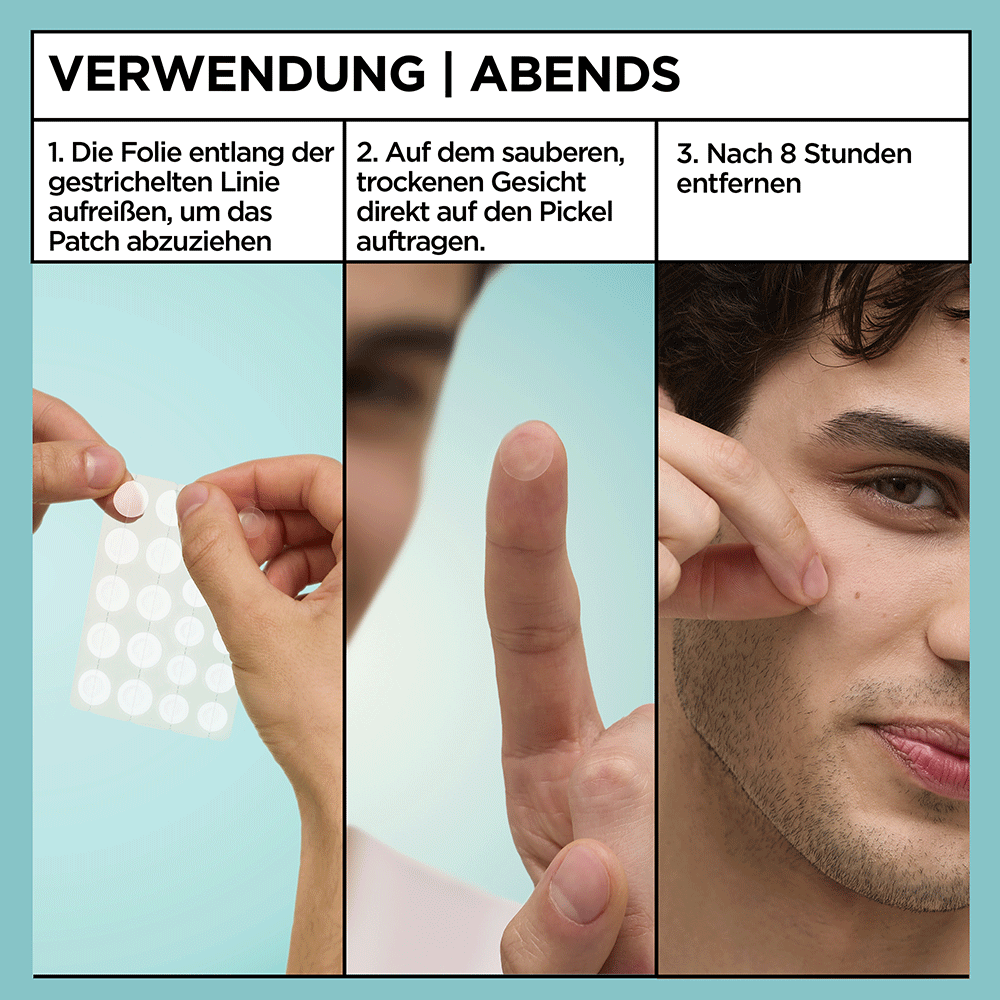 Bild: GARNIER Pimple Patch Ultra 