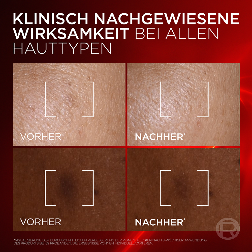Bild: L'ORÉAL PARIS Revitalift Laser Anti-Age Serum