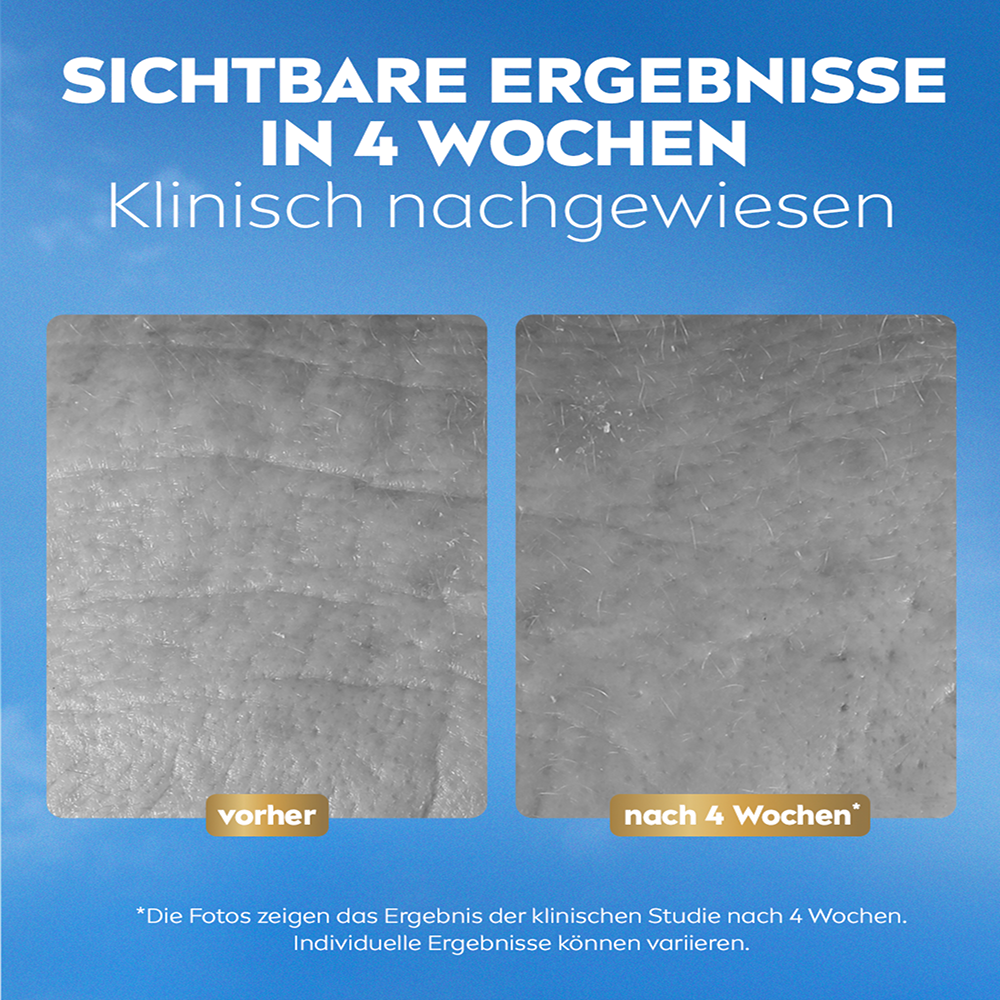 Bild: NIVEA Q10 Anti Falten Kollagen Experte Facial Butter Tag und Nacht