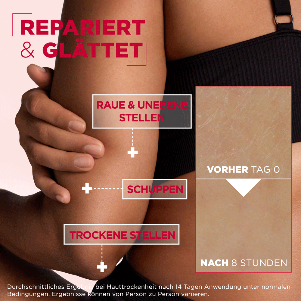 Bild: Mixa Urea Cica Repair Creme 