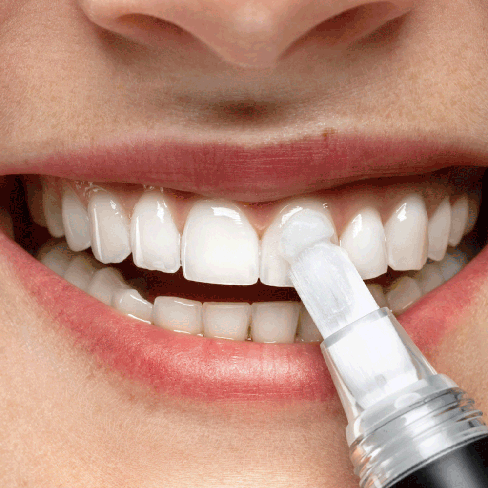 Bild: Smilepen pop Power Gel