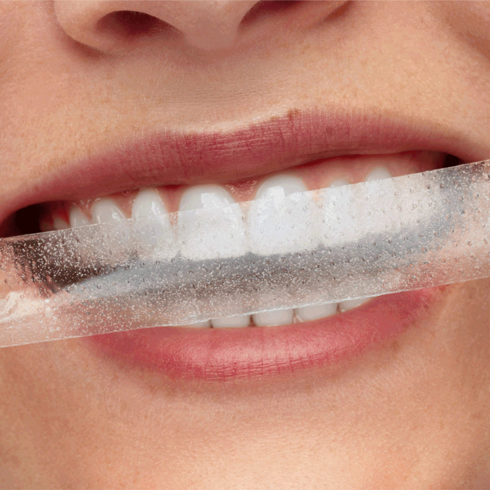 Bild: Smilepen pop Whitening Strips