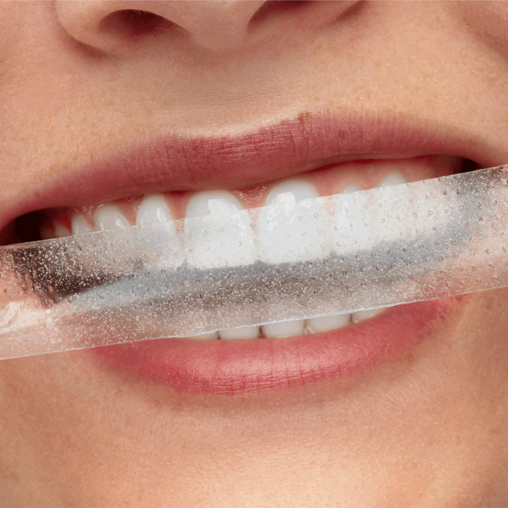 Bild: Smilepen pop Power Whitening Strips Kit 