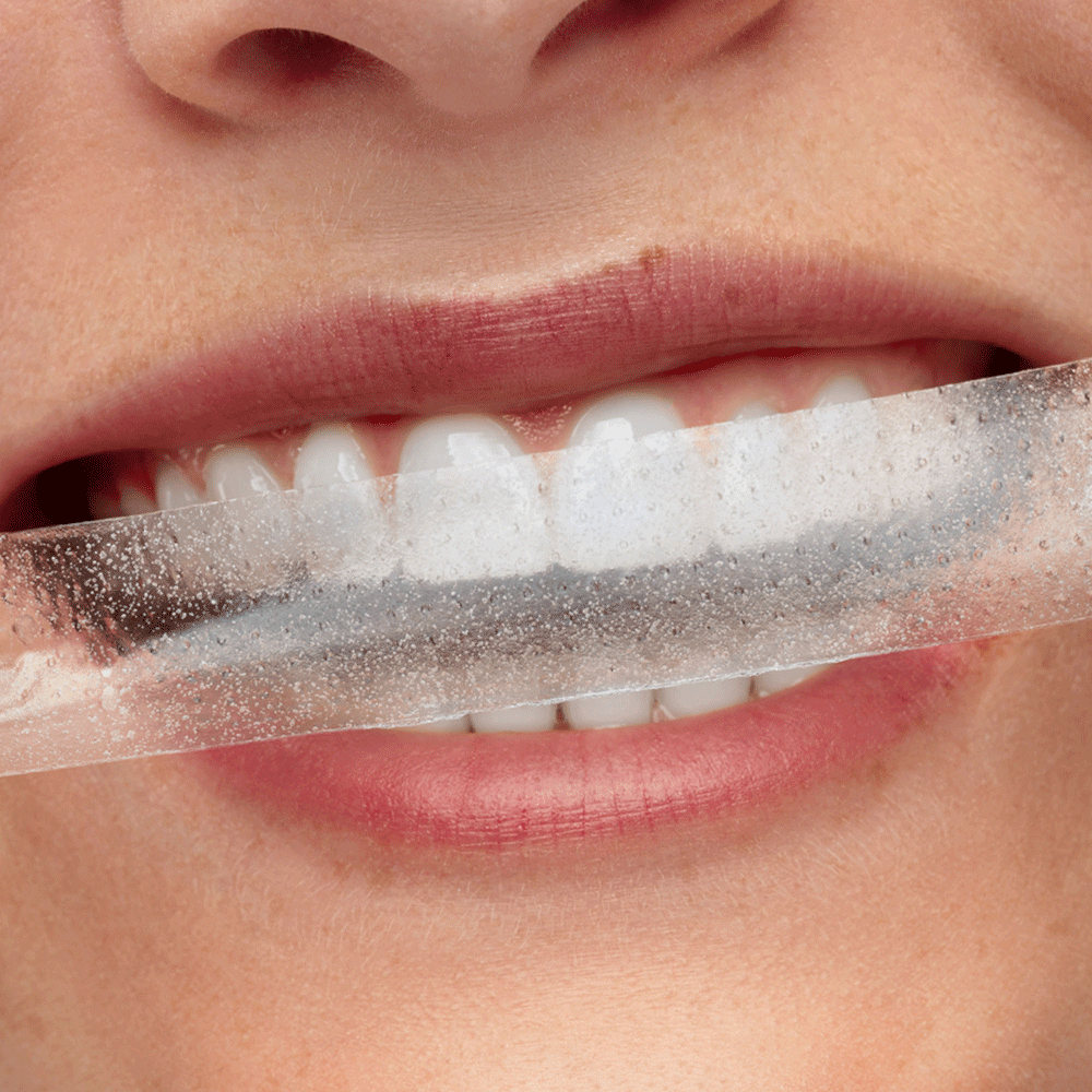 Bild: Smilepen pop Night Whitening Strips 