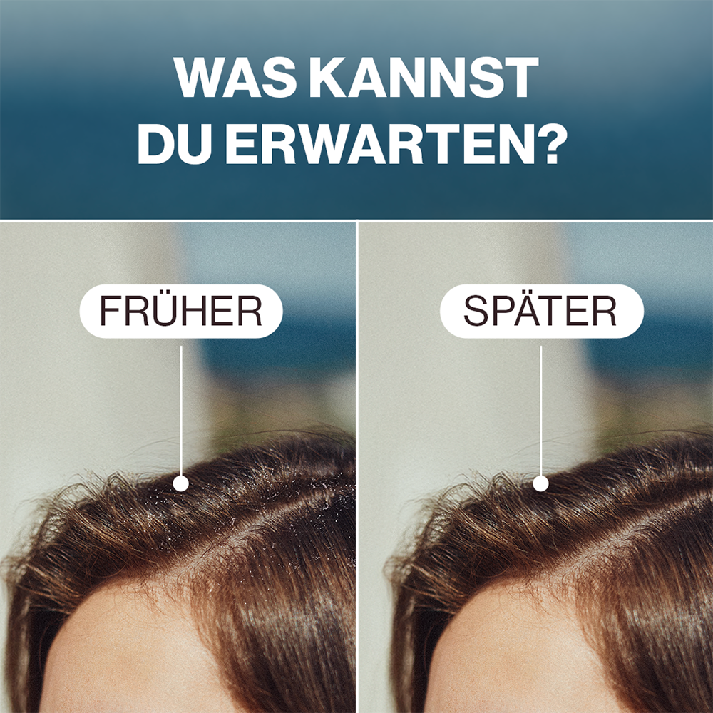 Bild: Naturavit Cremeshampoo gegen Schuppen 