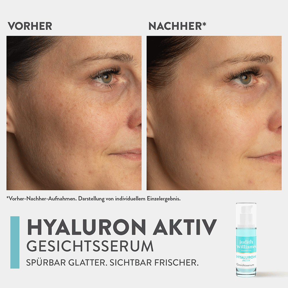 Bild: Judith Williams Cosmetics Gesichtsserum Hyaluron Aktiv