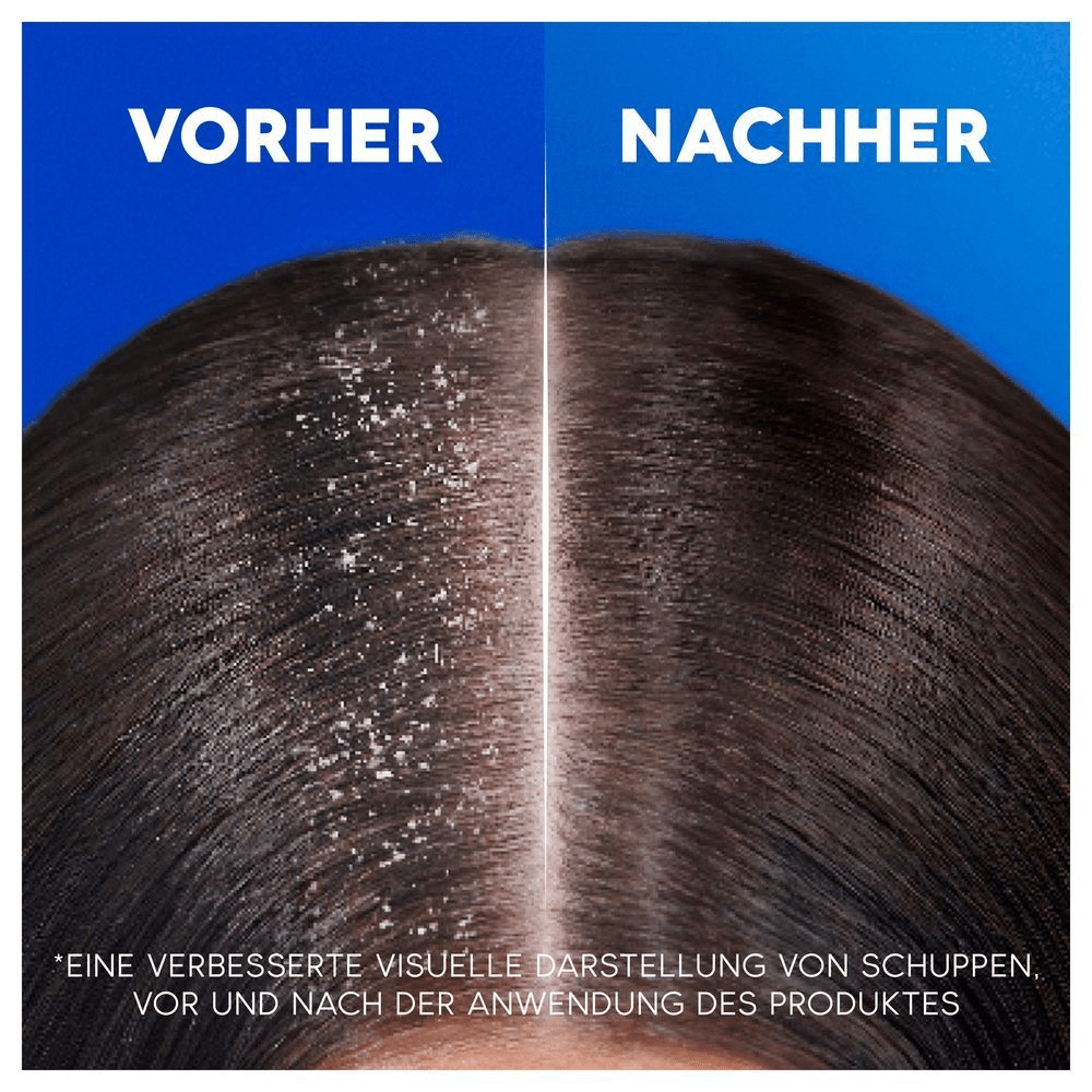 Bild: head & shoulders Apple Fresh Anti-Schuppen-Shampoo