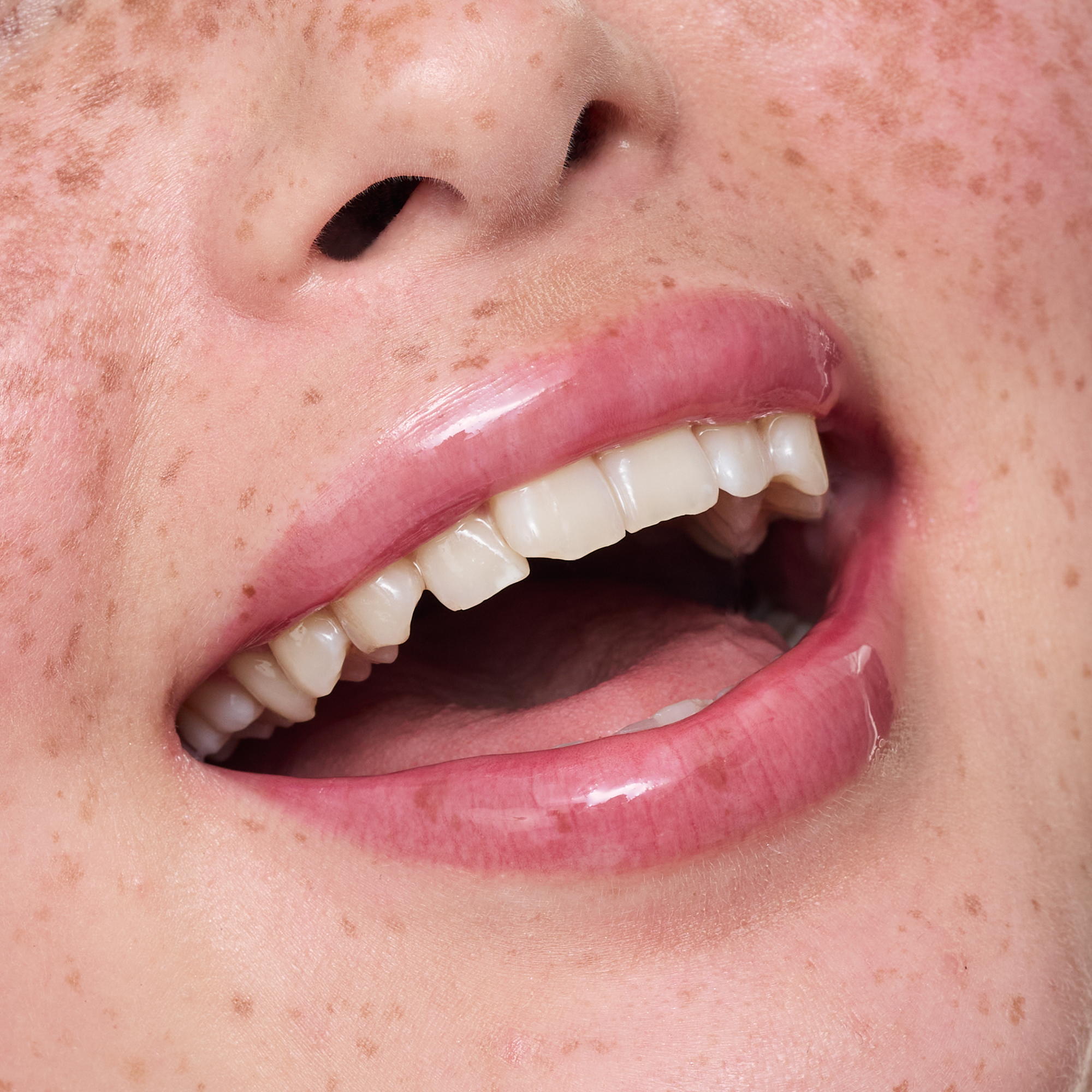Bild: essence JUICY SERUM hydrating lip treatment 