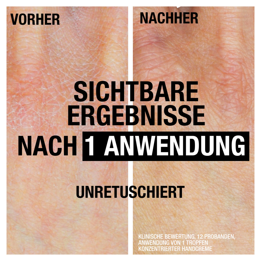 Bild: Neutrogena Intense Repair Handcreme 