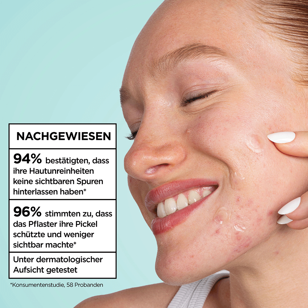 Bild: GARNIER Pimple Patch Ultra