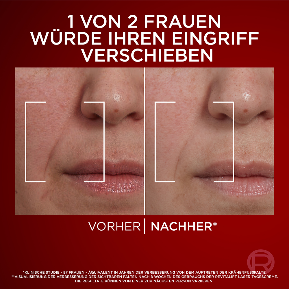 Bild: L'ORÉAL PARIS Revitalift Laser X3 Anti-Age Intensiv-Pflege LSF 20 