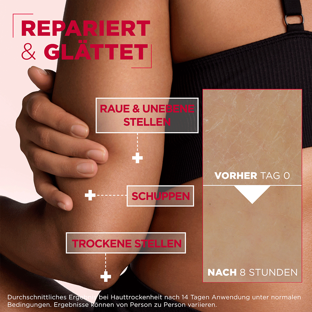 Bild: Mixa Urea Cica Repair Creme