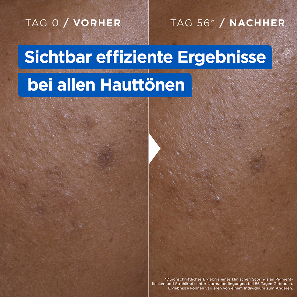 Bild: Mixa Niacinamide Bright Creme 